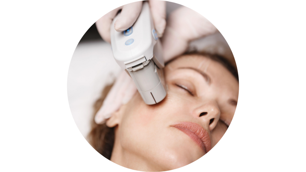 Mikro ultrahangos arclifting Budapesten | MySelf Szalon