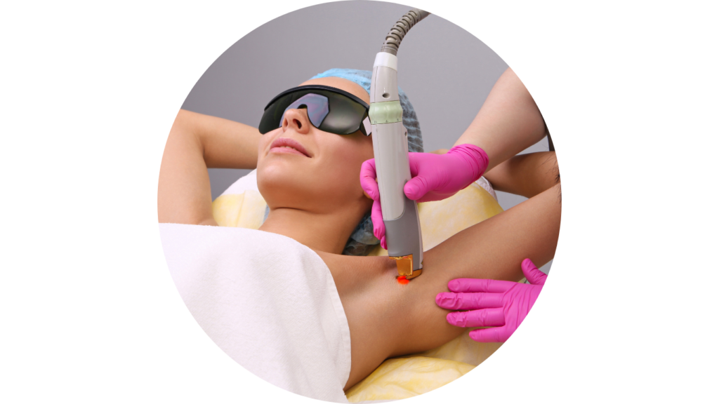 lézeres szőrtelenítés