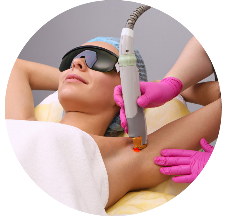 lézeres szőrtelenítés