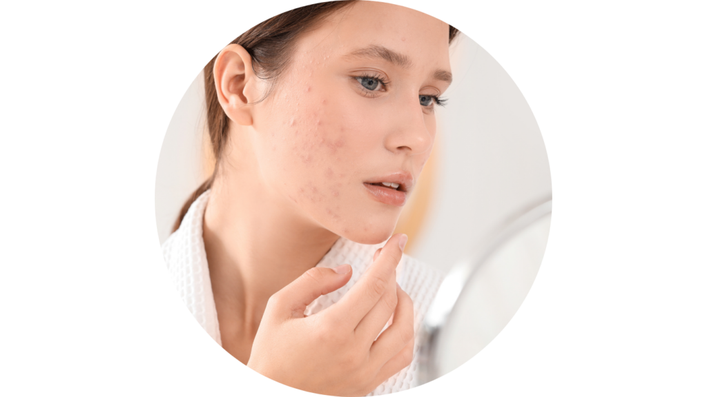 tini arckezlések budapest myself szalon